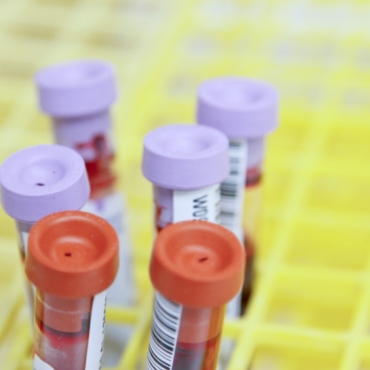 NHS возобновляет рутинные анализы крови после большой поставки пробирок