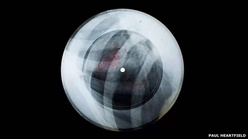 150129134625_x-ray_audio_bones-slide-43-2