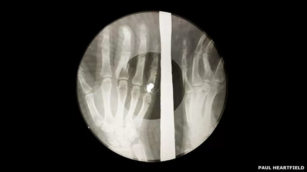 150129134625_x-ray_audio_bones-slide-49-2